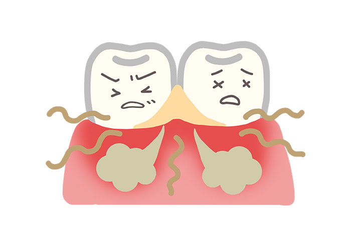 起床時に生理的口臭が強くなる原因